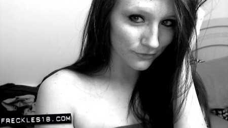 Freckles